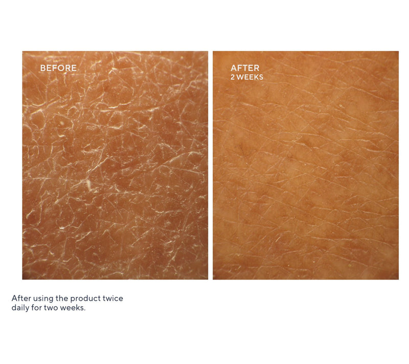 First Aid Beauty Ultra Repair Cream 14oz + 8oz Duo w/ Mini KP — View 6