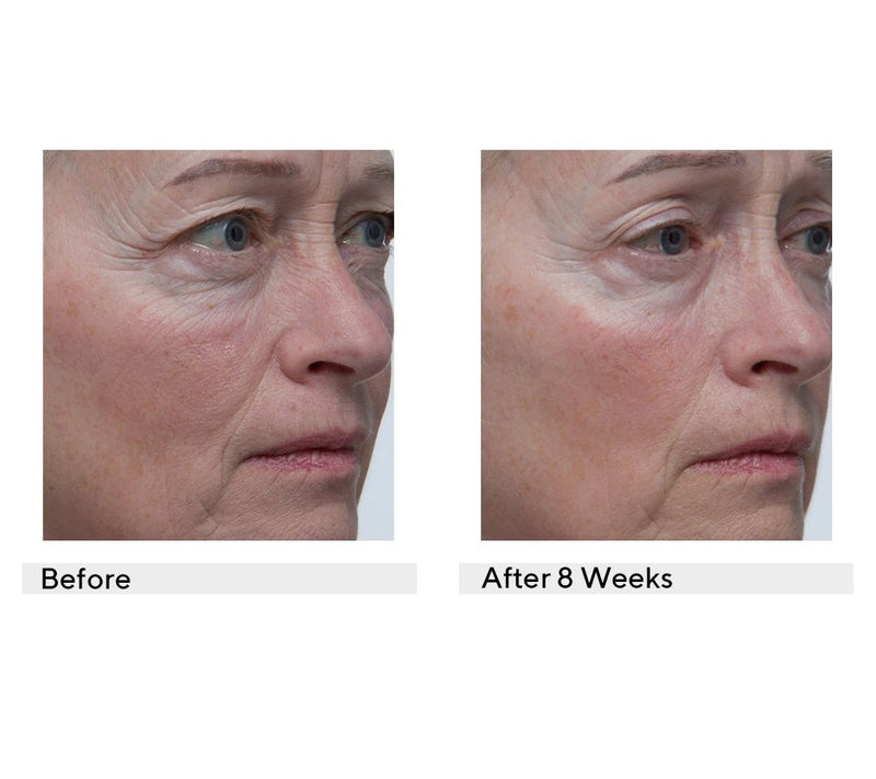 philosophy refresh your skin 4-piece skin care collection — View 3