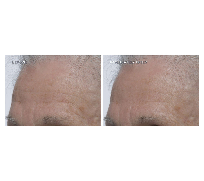 philosophy cleanse & restore your skin barrier 2pc collection — View 4