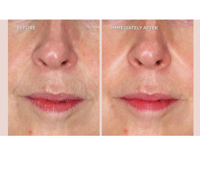 Project Plump Plump Fix Instant Hydrating Serum Duo — View 6