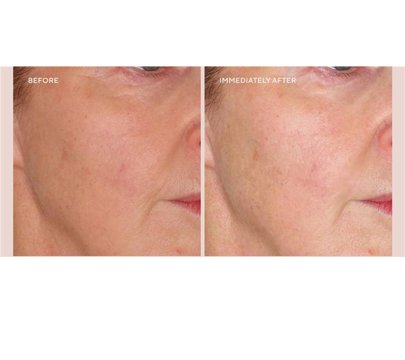 Project Plump Plump Fix Instant Hydrating Serum Duo — View 8