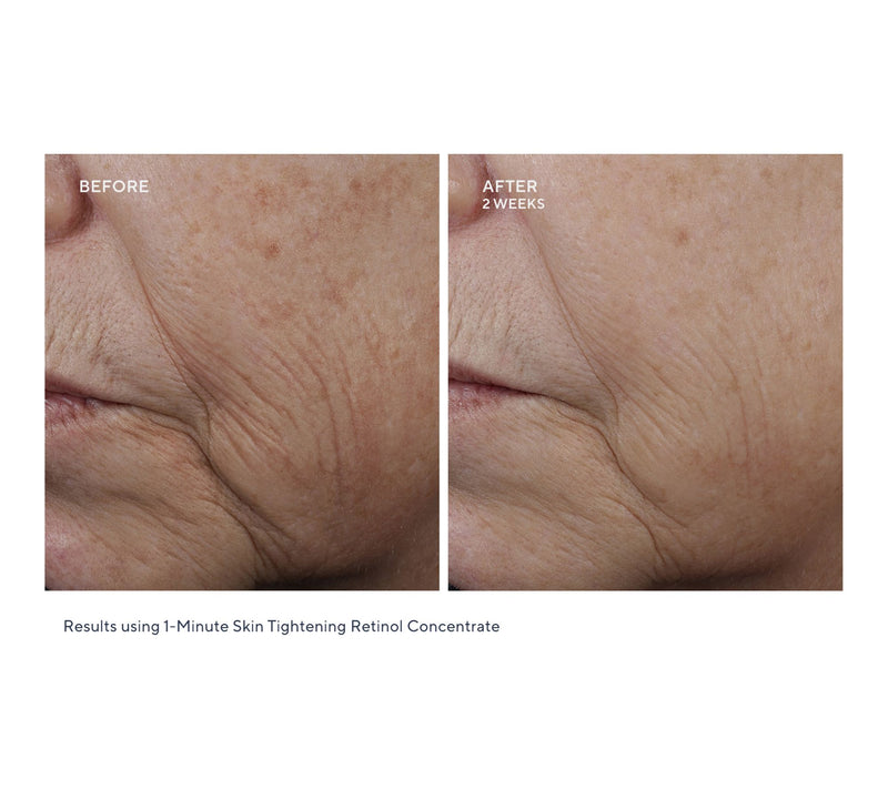 KAPLAN MD 1-Minute Skin Tightening Retinol Concentrate Duo — View 6