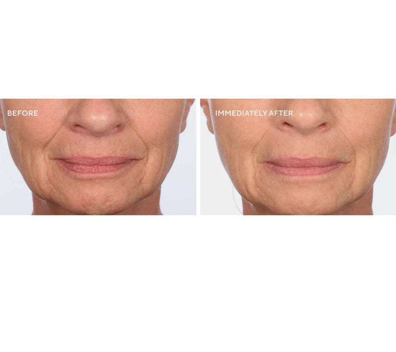SERIOUS SKINCARE Firm-a-face Duo With Bag — View 5