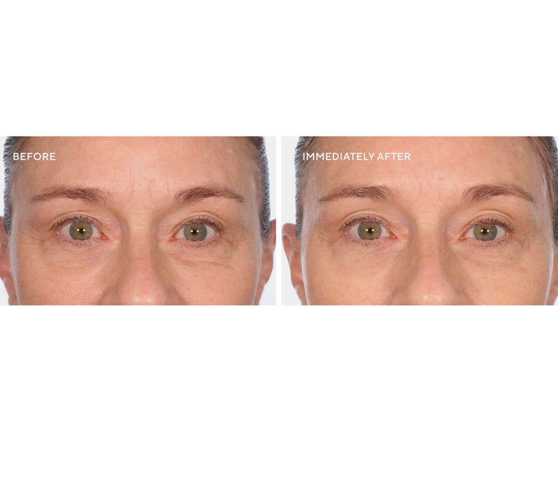SERIOUS SKINCARE Firm-a-face Duo With Bag — View 4
