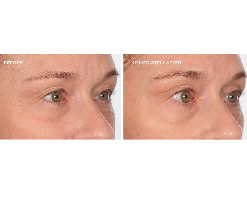 SERIOUS SKINCARE Firm-a-face Duo With Bag — View 6
