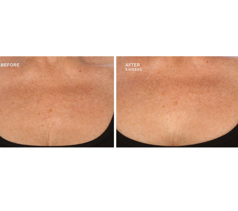 SERIOUS SKINCARE Gycolic Body Cream Trio — View 5