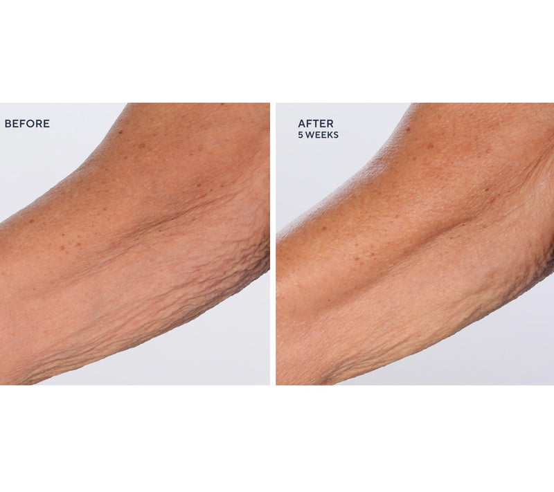 SERIOUS SKINCARE Gycolic Body Cream Trio — View 6