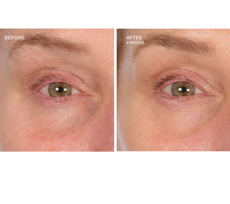 SERIOUS SKINCARE Reverse Lift Intense Cream & Reverse Eye Duo — View 3