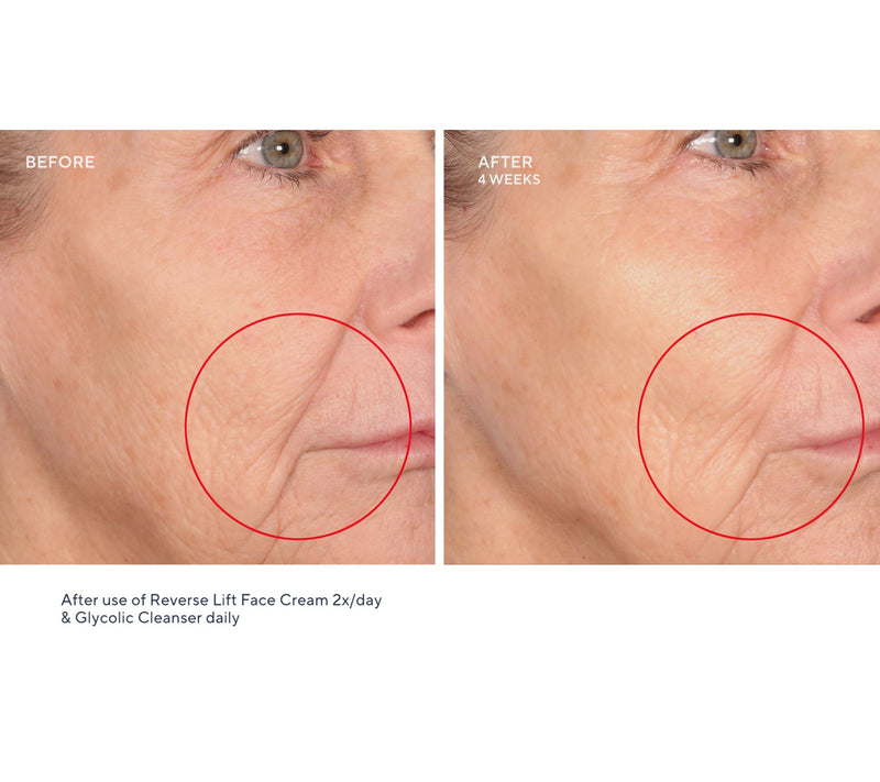 SERIOUS SKINCARE Reverse Lift Intense Cream & Reverse Eye Duo — View 7
