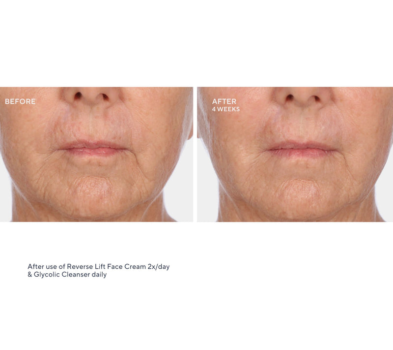 SERIOUS SKINCARE Reverse Lift Intense Cream & Reverse Eye Duo — View 4