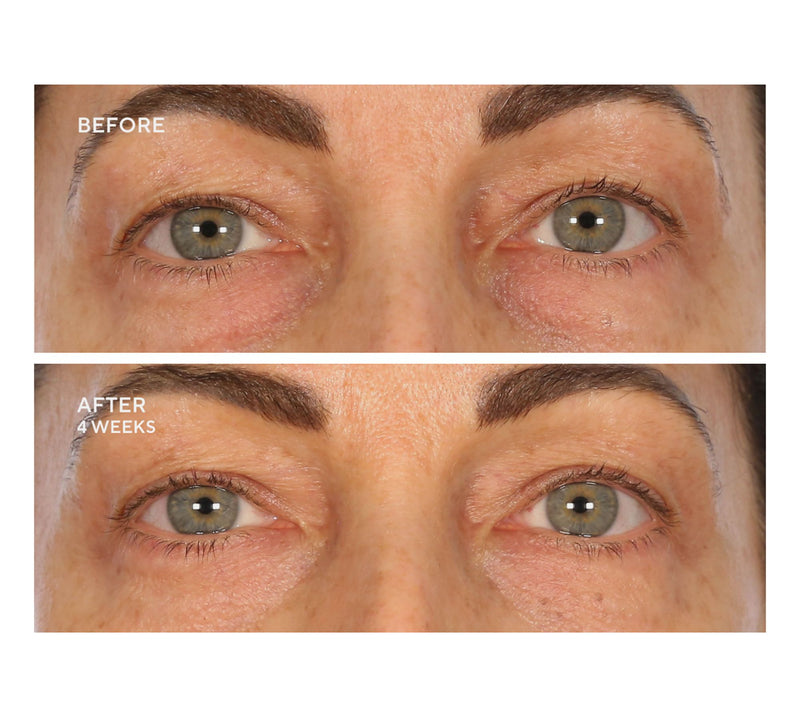 SERIOUS SKINCARE Reverse Lift Intense Cream & Reverse Eye Duo — View 2