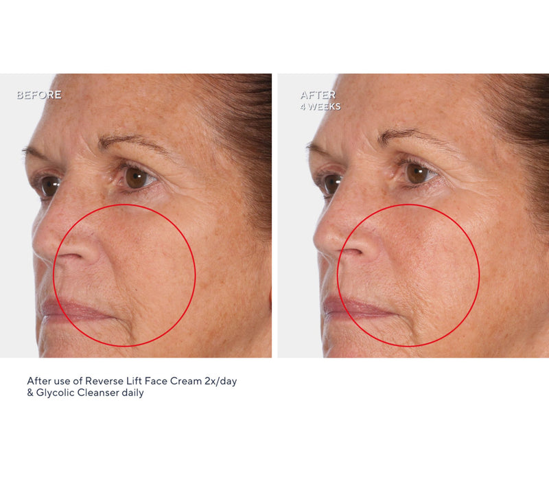 SERIOUS SKINCARE Reverse Lift Intense Cream & Reverse Eye Duo — View 8