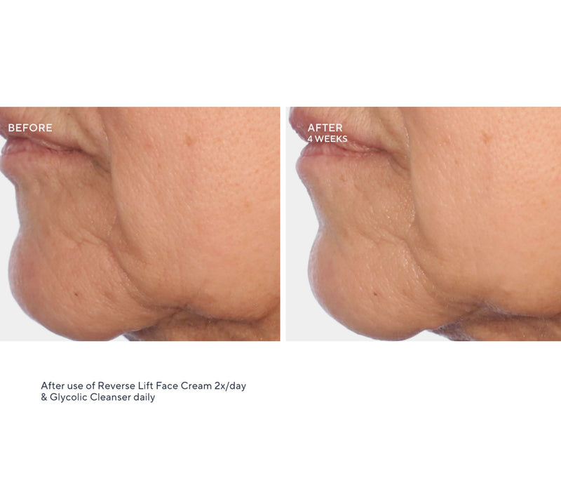 SERIOUS SKINCARE Reverse Lift Intense Cream & Reverse Eye Duo — View 6