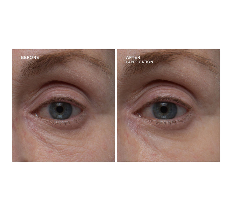 Dr.Denese HydroBurst Eye Mask Duo 60 Pairs — View 3