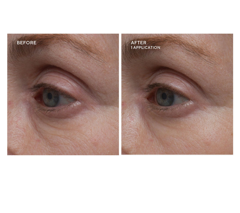 Dr.Denese HydroBurst Eye Mask Duo 60 Pairs — View 4