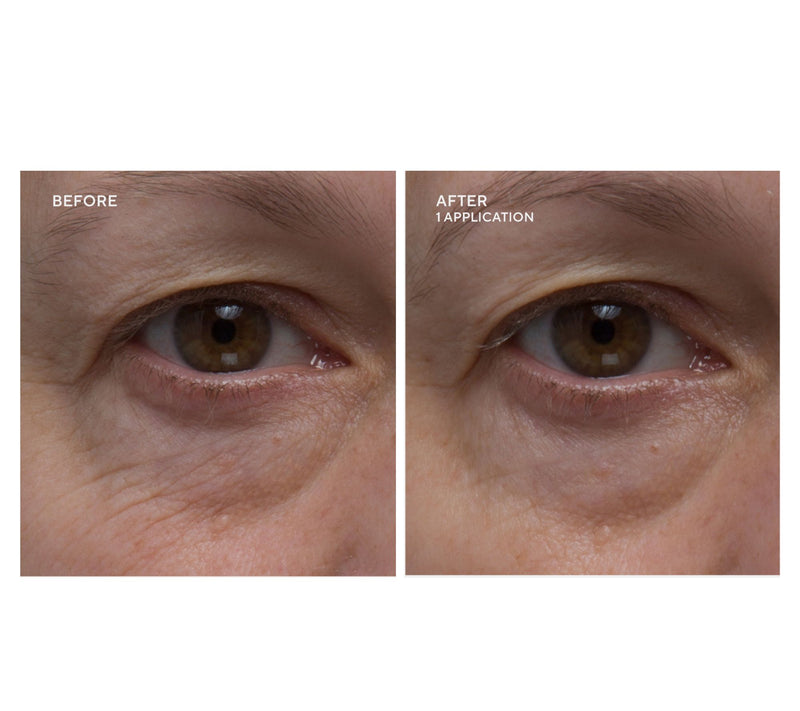 Dr.Denese HydroBurst Eye Mask Duo 60 Pairs — View 8