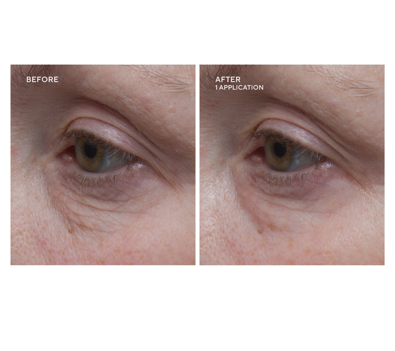 Dr.Denese HydroBurst Eye Mask Duo 60 Pairs — View 6