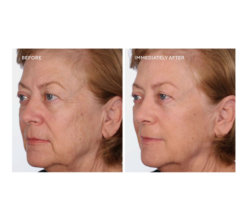 SERIOUS SKINCARE Super-Size InstaTox — View 7
