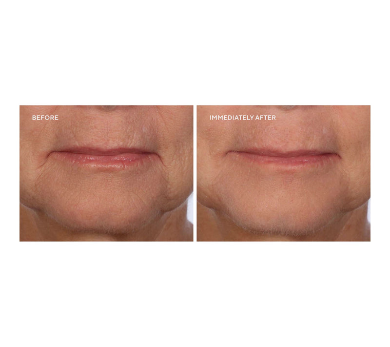 SERIOUS SKINCARE Super-Size InstaTox — View 4