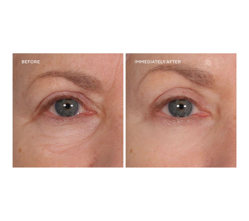 SERIOUS SKINCARE Super-Size InstaTox — View 2