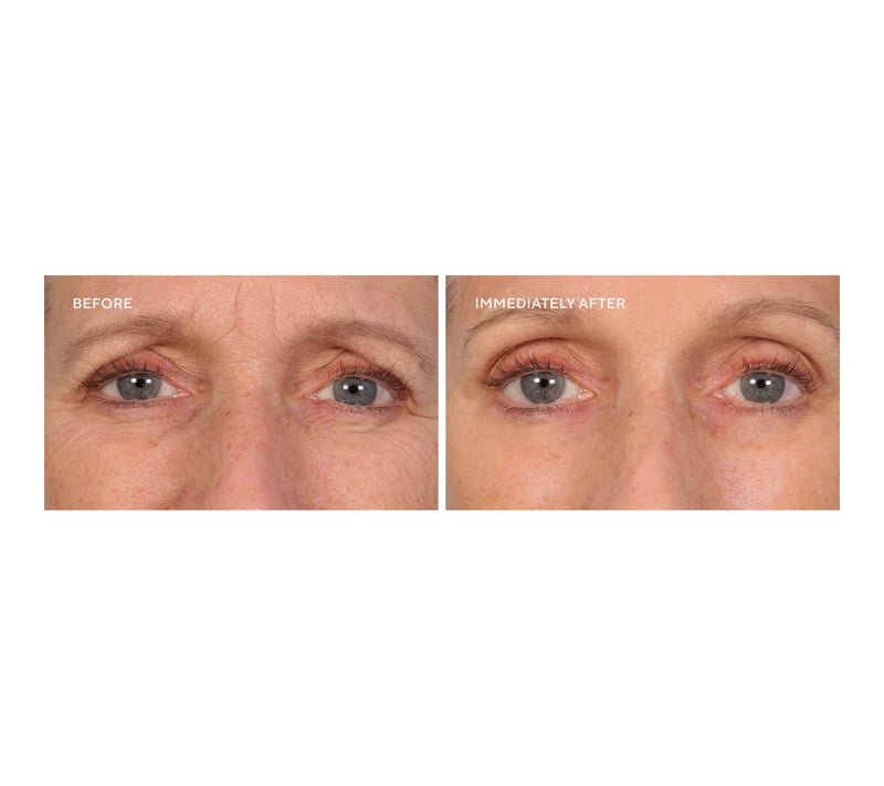 SERIOUS SKINCARE Super-Size InstaTox Auto-Delivery — View 8