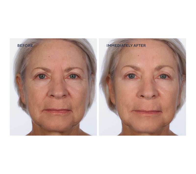SERIOUS SKINCARE Super-Size InstaTox Auto-Delivery — View 3