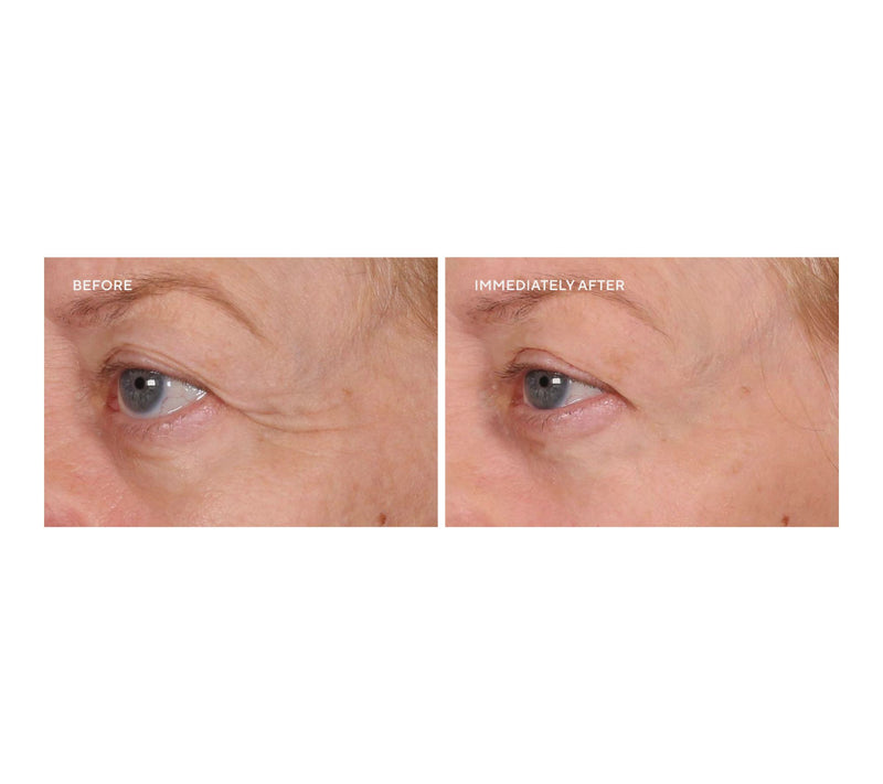 SERIOUS SKINCARE Super-Size InstaTox Auto-Delivery — View 6