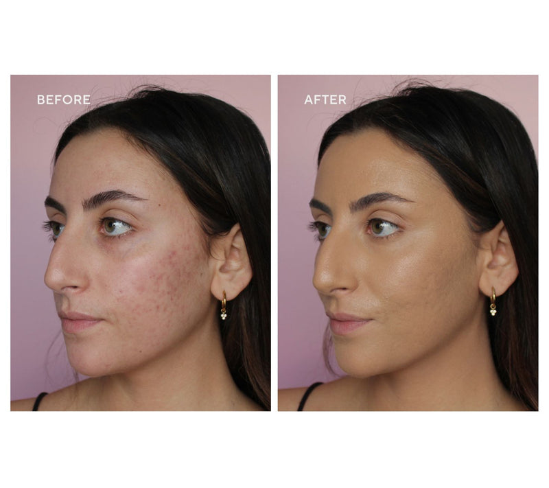 Doll 10 Plant Based Tinted Moisturizer w/ Bronzer & Brush — View 16