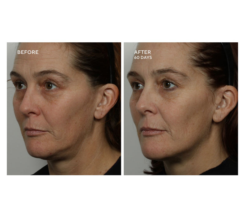 NuFace Trinity+ Facial Toning Device Complete Set w/ Aqua Gel — View 4