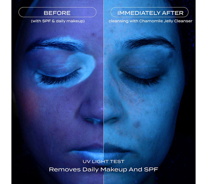 banu skin Acne Clearing System for Acne-Prone Skin — View 2