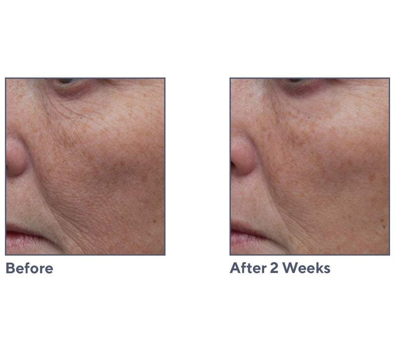 ELEMIS Pro-Collagen Marine Cream SPF30 & Ultra-Rich Duo — View 6