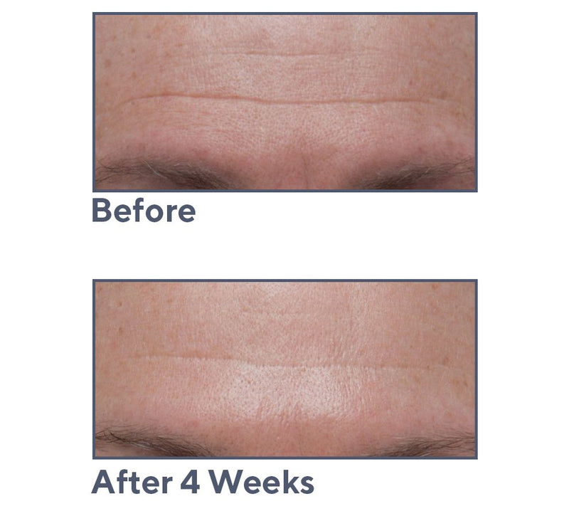 ELEMIS Pro-Collagen Marine Cream SPF30 & Ultra-Rich Duo — View 5