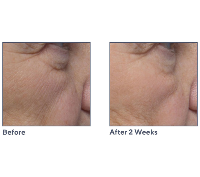 ELEMIS Pro-Collagen Marine Cream SPF30 & Ultra-Rich Duo — View 8