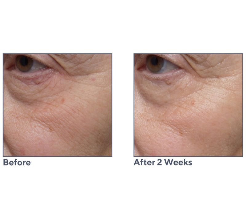 ELEMIS Pro-Collagen Marine Cream SPF30 & Ultra-Rich Duo — View 7