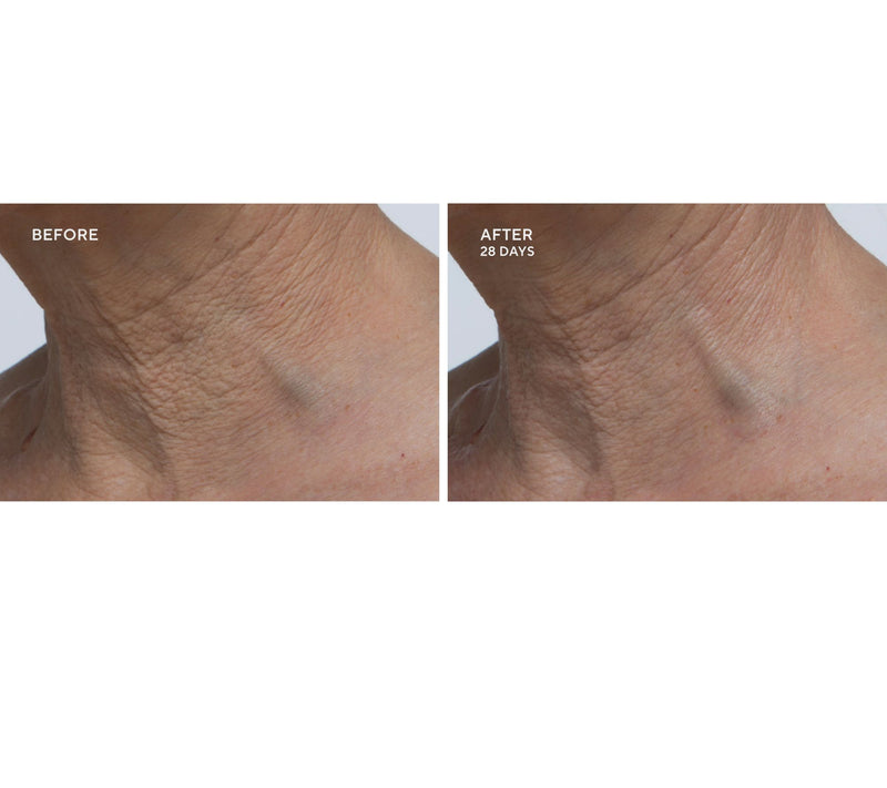 Dr.Denese HydroShield Face Emulsion — View 4