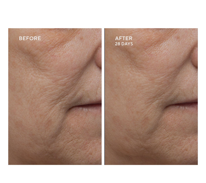 Dr.Denese HydroShield Face Emulsion — View 8