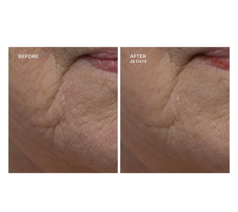 Dr.Denese HydroShield Face Emulsion — View 2
