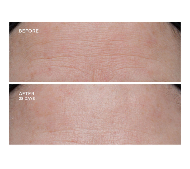 Dr.Denese HydroShield Face Emulsion — View 5