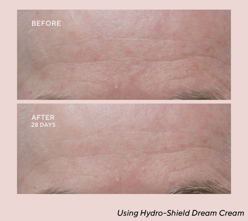 Dr.Denese HydroShield Serum & Dream Cream 4pc Home & Away Set — View 7