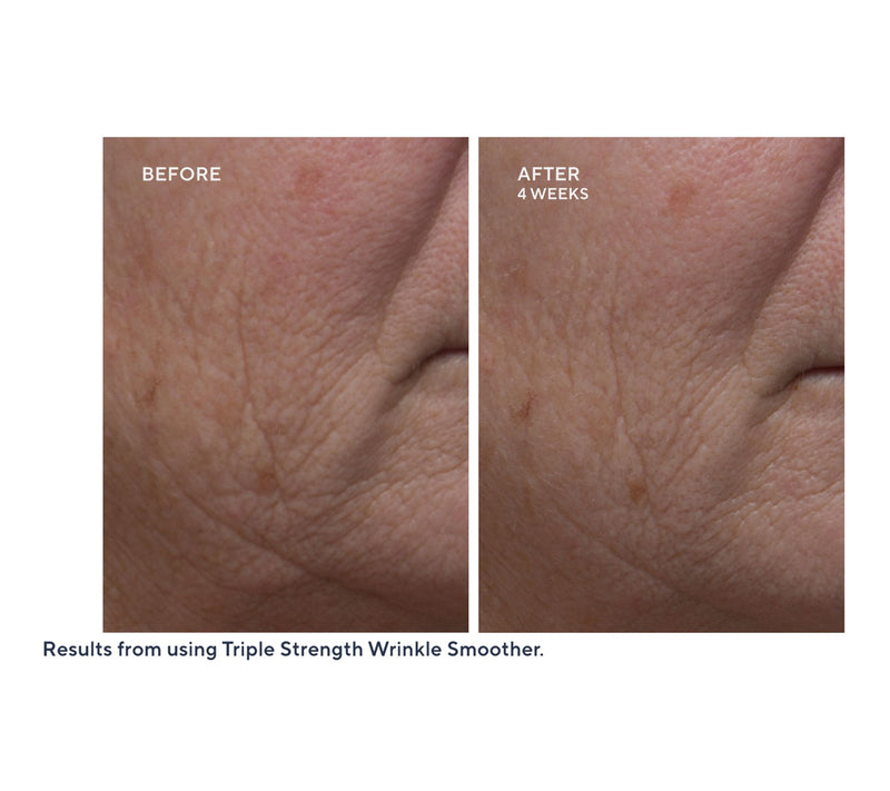 Dr. Denese Super-Size Essential Day and Night Moisturizer Duo — View 3