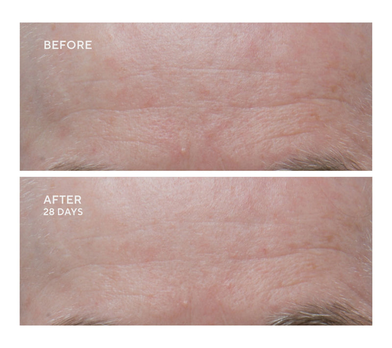 Dr. Denese Super-Size Essential Day and Night Moisturizer Duo — View 6