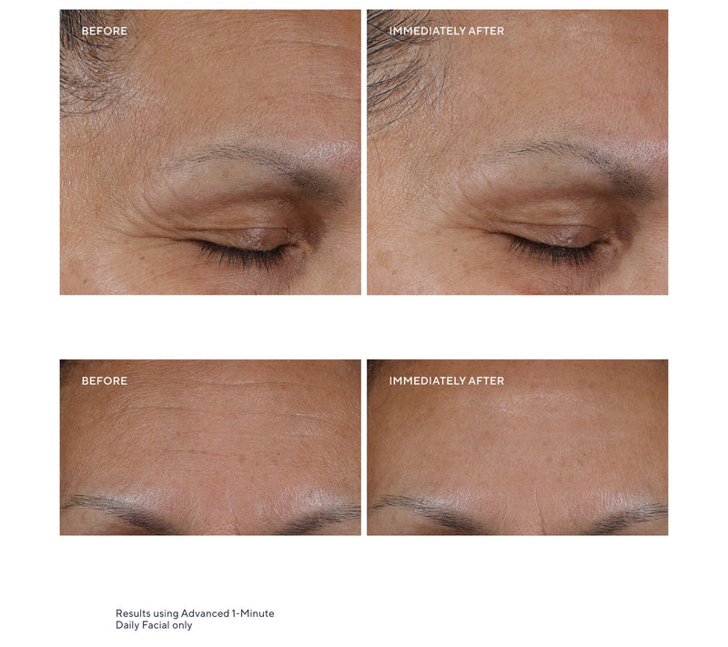 KAPLAN MD Diamond Contour Adv1 Min Facial Super Size Home & Away Set — View 5