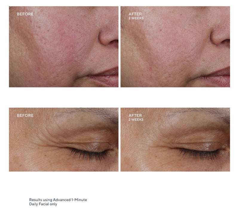KAPLAN MD Diamond Contour Adv 1Min Facial SS Home & Away Auto-Delivery — View 6