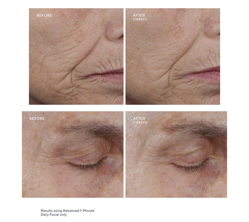 KAPLAN MD Diamond Contour Adv 1Min Facial SS Home & Away Auto-Delivery — View 7