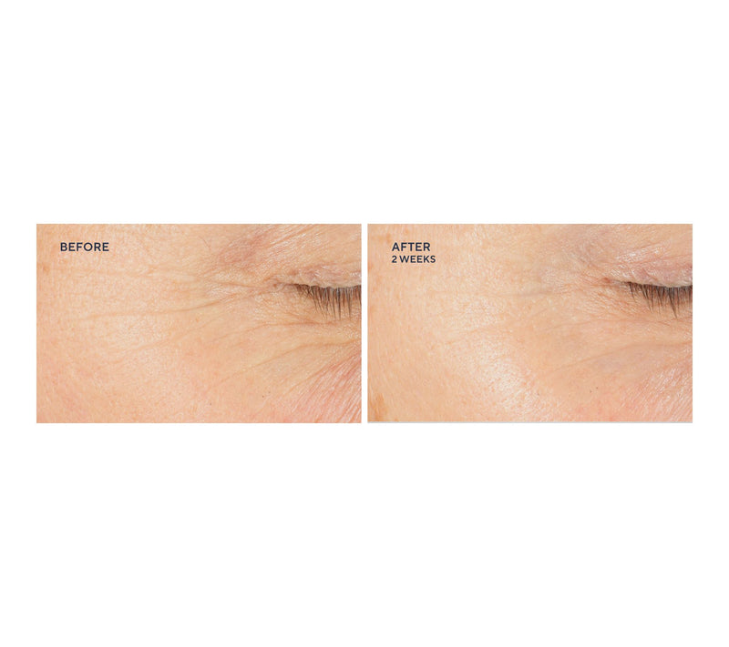 KAPLAN MD Super Size Collagen Creme Home & Away Set Auto-Delivery — View 3