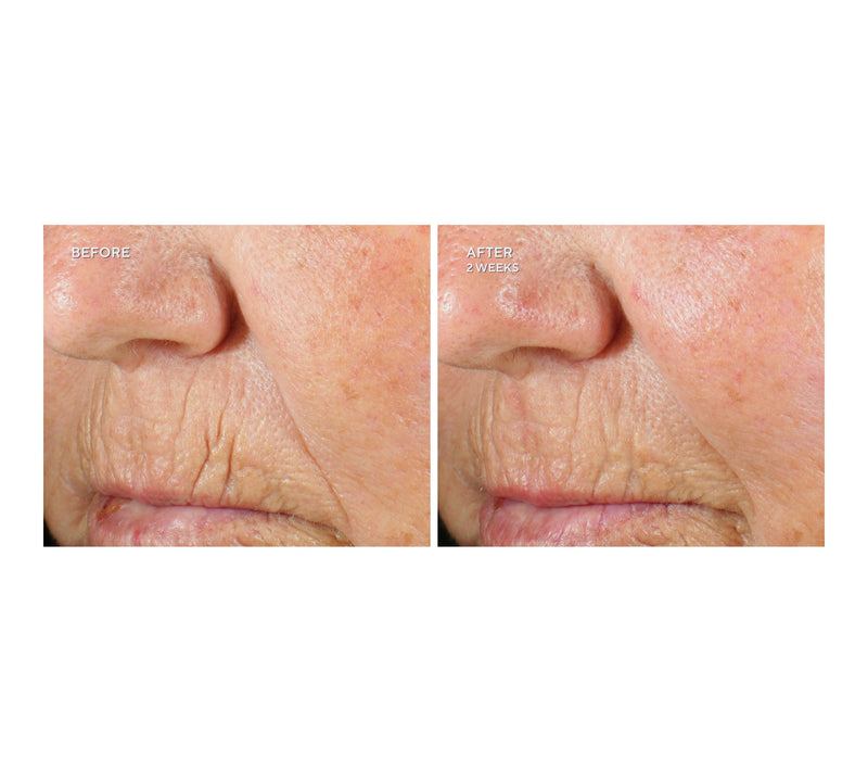 KAPLAN MD Super Size Collagen Creme Home & Away Set Auto-Delivery — View 5