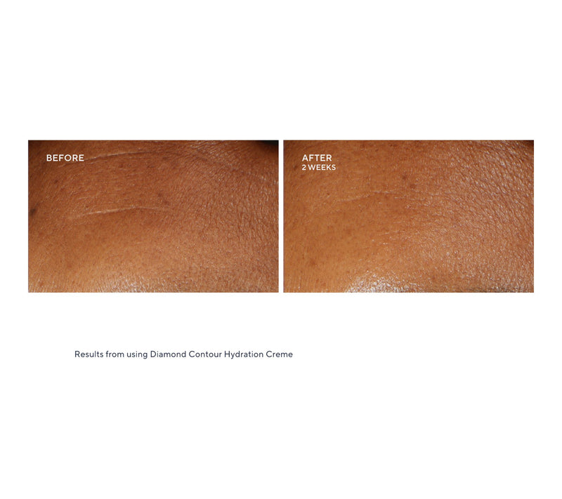 KAPLAN MD Super Size Collagen Creme Home & Away Set Auto-Delivery — View 6