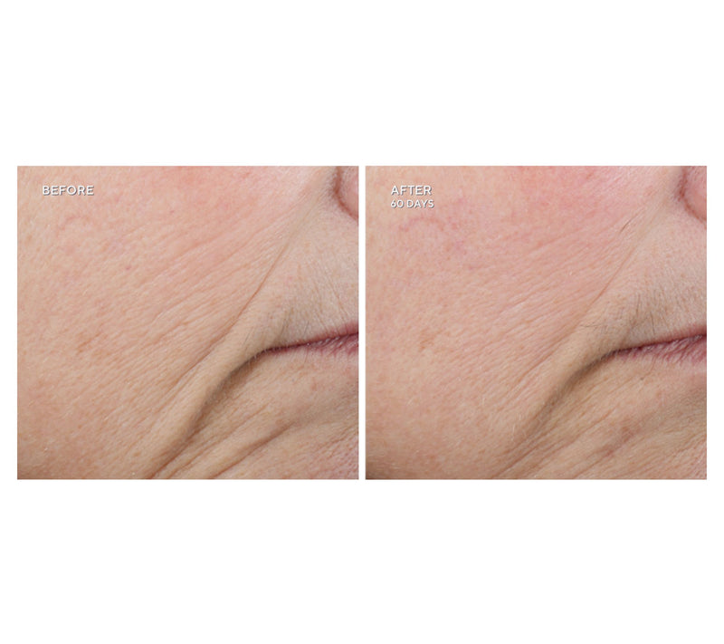 NuFace Trinity+ Facial Toning Device Complete Set Auto-Delivery — View 5
