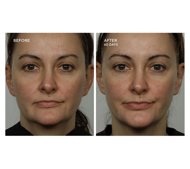 NuFace Trinity+ Facial Toning Device Complete Set Auto-Delivery — View 3