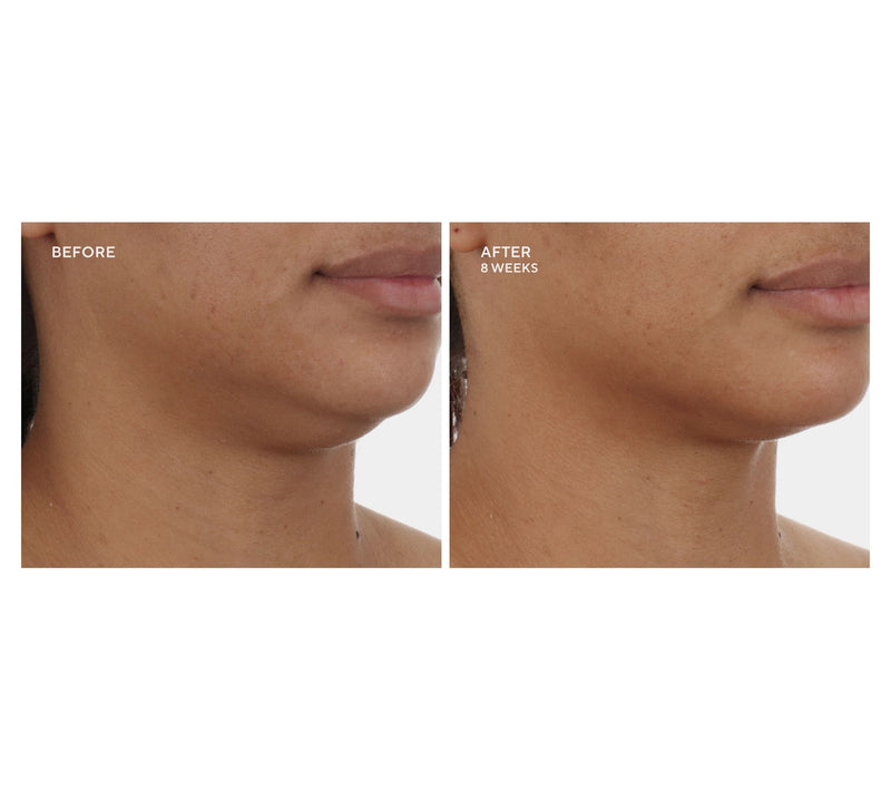 NuFace Trinity+ Facial Toning Device Complete Set Auto-Delivery — View 8